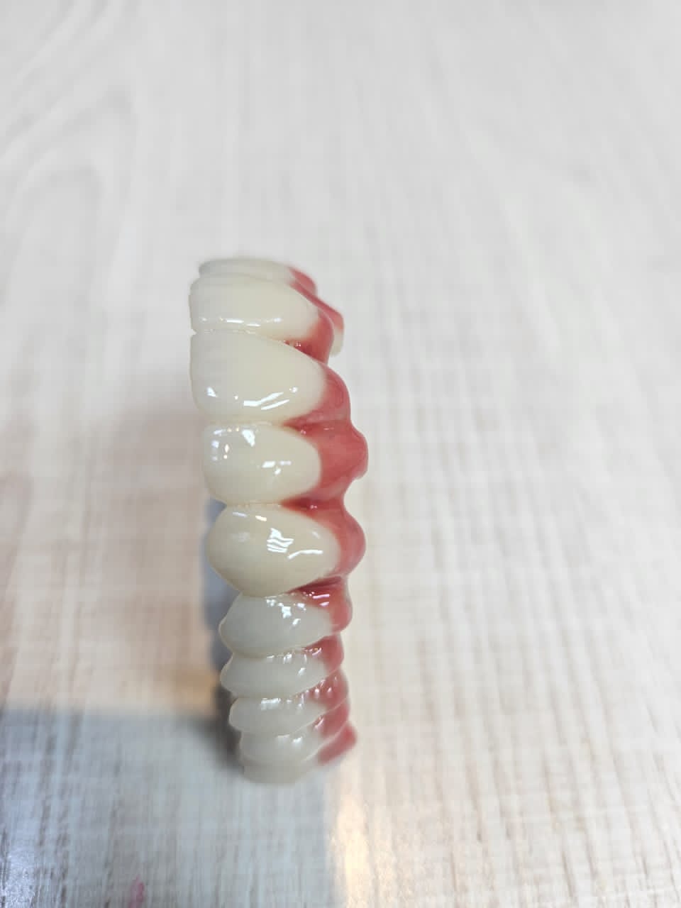 Dental Restoration Case 1